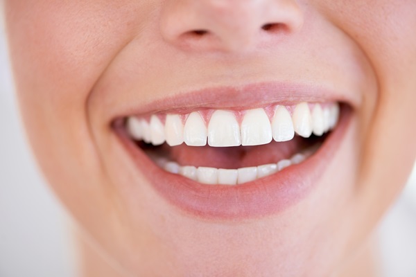 How To Maintain Teeth Whitening At Home